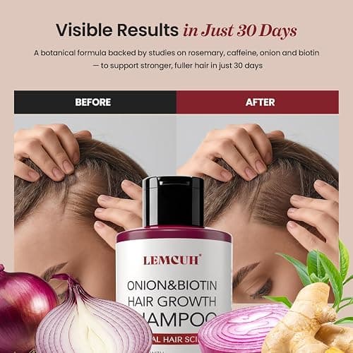 Onion & Biotin Hair Growth Shampoo: Infused With Natural Rosemary Tea Tree Anti Hair Loss Shampoo - Scalp Smooths Thickening Formula Support Hair Regrowth For Women Men 12.5Fl Oz thumbnail 5