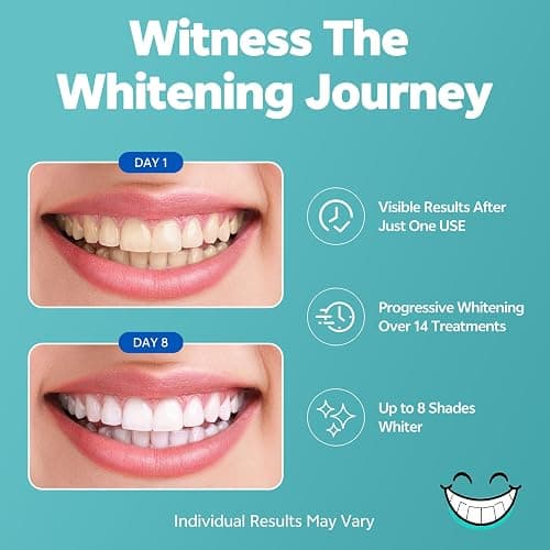 SmileFreshness Teeth Whitening Strips, 14-Day Treatments Clinically Proven for Visible & Affordable Teeth Whitening, Enamel Care Whitening, Reduced Sensitivity Formula, Coconut. thumbnail 3