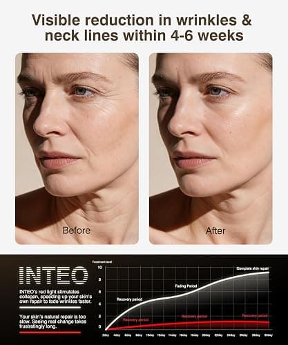 Red Light Therapy for Face and Neck, 4 Modes Cordless Face Mask Light Therapy with Neck Masks, 850nm Infrared & Red Light Mask, 2000mAh Rechargeable Light Therapy Skin Care at Home (680 Beads) thumbnail 3