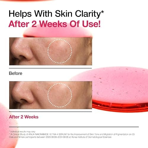 Anua Ultimate Spot Duo, Niacinamide 10 + TXA 4 Serum & Azelaic Acid 10 Hyaluron Redness Soothing Serum, Early & Post Spot Care, Skin Clarifying, Natural Color, Korean Skincare Set thumbnail 7