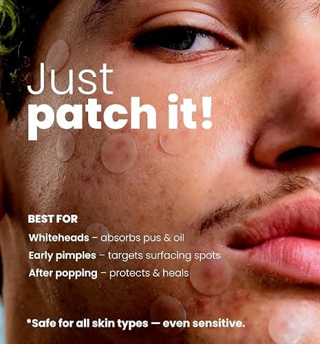 ROSELYNBOUTIQUE Pimple Patches - Hydrocolloid Spot Patches for Blemishes – 300 Clear Dots – Vegan & Cruelty-Free – Cosmetic Facial Skincare Product thumbnail 5