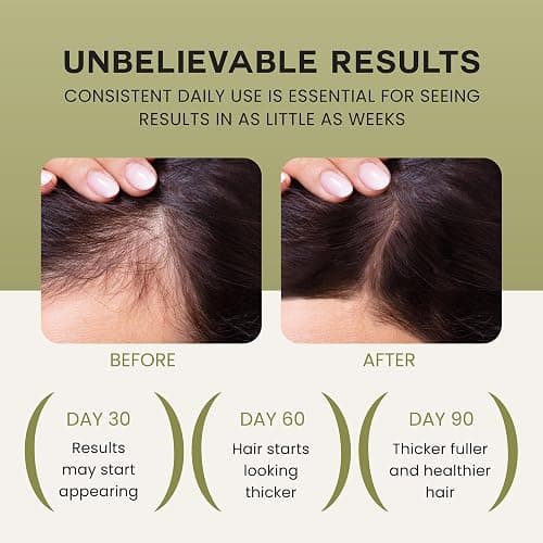 Lebanta Batana Oil For Hair Growth - 100% Pure, Raw & Natural Blend With Organic Castor, Pumpkin Seed, Coconut and Rosemary Oil - Thicker, Stronger Hair Gifts For Men & Women Scalp (1 Pack) thumbnail 3