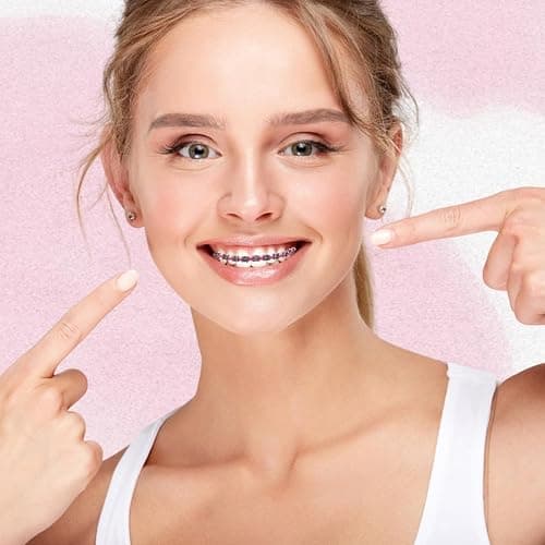 Fake Braces 2-Pcs Set Temporary Tooth Decoration with Metal Wires, Metal Brackets and Orthodontic Bands, Suitable for Orthodontists to Explain, for Dental Students to Practice (Pink) thumbnail 4