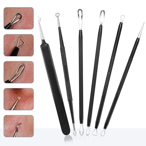 Blackhead Remover Pimple Popper Tool Kit - (6 Piece Kit) - Professional Stainless Pimples Comedone Extractor Removal Tool thumbnail 2