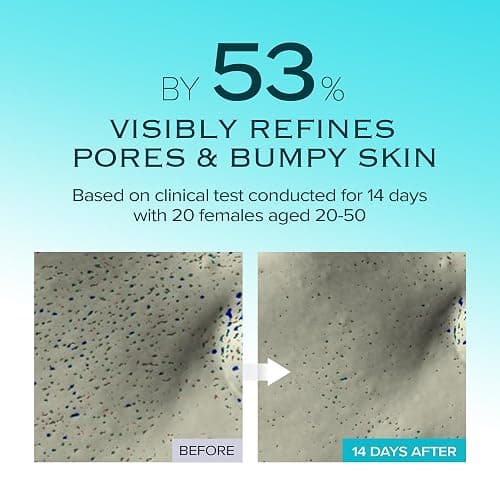 mimmua! Ice Sorbet Soothing & Cooling Face Moisturizer | Non-Comedogenic Gel Cream for Fungal Acne | Pore Minimizer for Face Under | Makeup Primer | Niacinamide & Silica for Sebum Control | 3.38 Fl Oz thumbnail 4