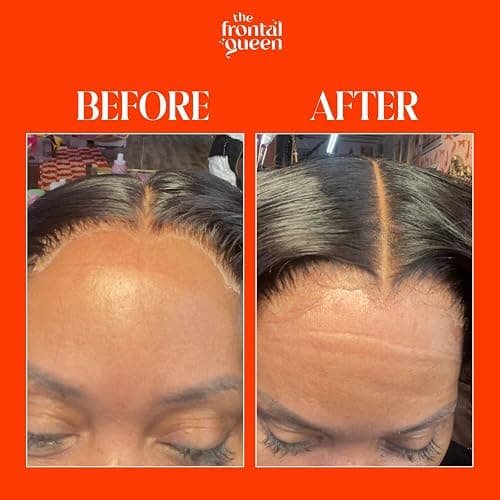The Frontal Queen Lace Melting Spray, Ashy Lace Melting Spray for Lace Wigs, Lace Bond Spray, Extra Hold Lace Melting Spray Adhesive Wig, No Residue, Long Lasting Safe Formula - 4.2 oz thumbnail 3