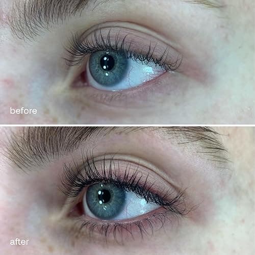 UKLASH | Sensitive Eyelash Serum | UK's #1 Rated Lash Serums for Fuller Lashes, Peptide Based, Vegan Friendly Designed for Sensitive Eyes thumbnail 2