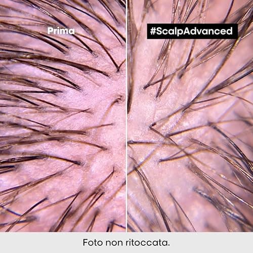 L'Oréal Professionnel Paris Trattamento Disciplinante Lenitivo, Per Cuoio Capelluto Sensibile, Con Niacinamide, Anti-Discomfort, Scalp Advanced, 200 ml thumbnail 4