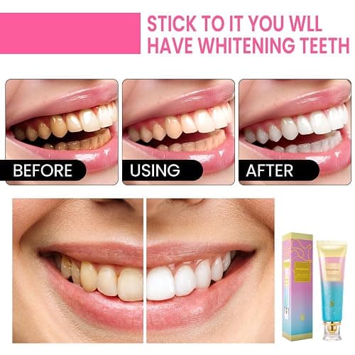 BodyAccel Niacinamide Whitening Toothpaste, Brightens and Whitens Teeth, Stain Removal Natural Gentle, Fresh Breath thumbnail 8