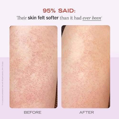 First Aid Beauty - KP Bump Eraser Body Scrub with 10% AHA, Keratosis Pilaris Exfoliator with Glycolic and Lactic acids, Helps Reduce Chicken Skin Bumps, Safe for Sensitive Skin, Strawberry Scent, 8 oz - Fresh Strawberry - 8 Ounce thumbnail 4