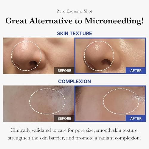 medicube Flawless Skin: Deep Vitamin C Golden Capsule Face Moisturizer and Zero Exosome Shot 7,500 PPM Spicule Facial Serum thumbnail 3