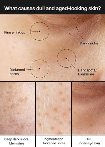 Dark Spot Cream thumbnail 3