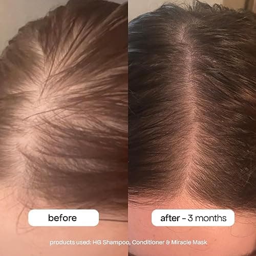 BondiBoost HG Anti-Thinning Shampoo Conditioner Set [16.90 fl oz each], Clinically Tested to Promote Fuller + Thicker-Looking Hair for Women & Men, Procapil, Redensyl & Rosemary Formula, Sulfate-Free thumbnail 4