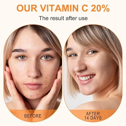 Premium 20% Vitamin C Serum For Face with Hyaluronic Acid, Retinol & Amino Acids - Boost Skin Collagen,Hydrate & Plump Skin, Anti Aging & Wrinkle Facial Serum 60ml thumbnail 5