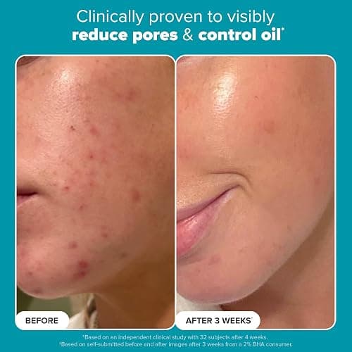 Paula's Choice SKIN PERFECTING 2% BHA Liquid Exfoliant with Salicylic Acid, Facial Polish for Enlarged Pores, Wrinkles & Fine Lines, Suitable for Blackhead-Prone Skin, Fragrance-Free thumbnail 4