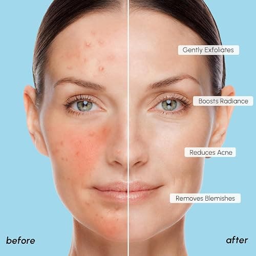 MAREE Glycolic Acid Pads - Toner Pads for Face Cleansing - Exfoliating Pad with Tea Tree Oil, Salicylic Acid & Vitamins E, B3, B5 - Acne Clearing, Skin Pore Resurfacing & Radiance Device - 50 Count thumbnail 5