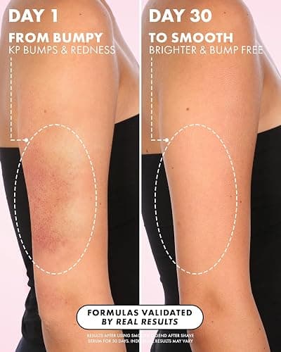 Truly Beauty Luxury After Shave Serum | Soothing & Hydrating Post Shave Treatment to Prevent Ingrown Hair For Smooth, Irritation-Free Skin thumbnail 8