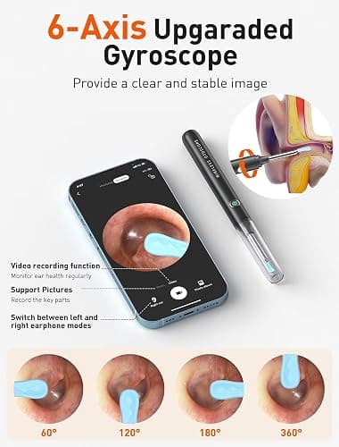 Ear Wax Removal Tool Camera - Ear Cleaner with 1080P HD Camera, Otoscope with Light, Earwax Removal Kit with 50 Replacement Tips for iPhone, iPad, Android Phones (Black) thumbnail 6
