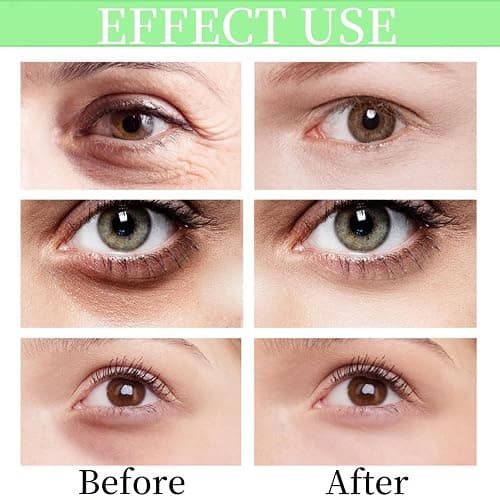 15ml Skincare Eye Cream,Skincare Morning Rays Brightening Eye Cream,Slam Dunk Hydrating Face Moisturising Cr/eam,Face Moisturizer,Vitamin C Under Eye Cre/am,Calm for Dark Circles thumbnail 2