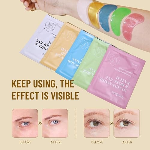 Yeokoe Under Eye Patches for Dark Circles,Eye Mask for Puffy Eyes With Collagen,Retinol,Vitmin C,Hyaluronic Acid and Niacinamide Face Masks Skincare Spa Gifts for Woman 20Pairs thumbnail 4