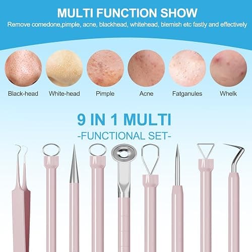 Pimple Popper Tool Kit Blackhead Remover Tools (5 Piece Kit), Professional Stainless Black Head Remover for face, Risk Free Treatment Pimple Extractor with Tweezers thumbnail 3