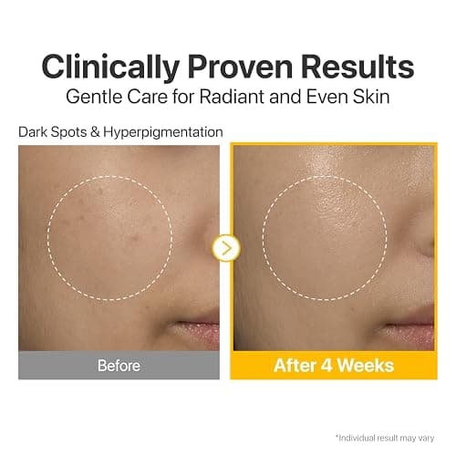 numbuzin No.5 Vitamin Concentrated Serum, Dark Spot Care, Glutathione & Vitamin Serum, Korean Skincare, Tranexamic Acid 4%, Niacinamide 5%, for a Radiant-Looking Glow 1.01 fl oz thumbnail 4