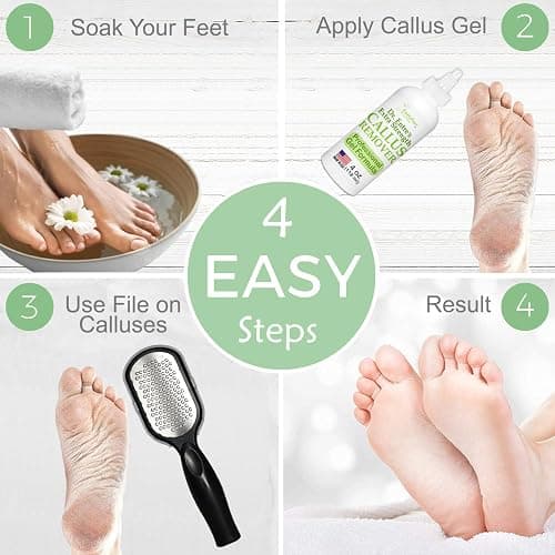 Callus Remover Gel & Foot File thumbnail 6