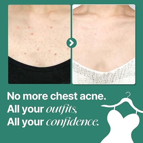 SOME BY MI AHA BHA PHA 30 Days Miracle Acne Clear Body Cleanser – 13.5oz, 400ml – Daily Exfoliating Tea Tree & Salicylic Acid Acne Body Wash – Deep Cleanses Sebum, Oil & Impurities – Korean Skin Care thumbnail 6