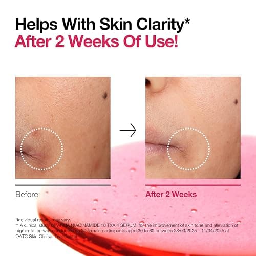 ANUA 10% Niacinamide+ 4% TXA Serum, Ceramide, Hyaluronic Acid, Tranexamic Acid, Vitamin B12 Natural color, Korean Glass Skin, Fragrance-Free, Dark Spot Serum, Korean Skincare, 30ml /1.01 fl.oz. thumbnail 6