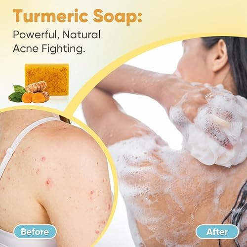 Treeroot 5 Pack Turmeric Soap for Dark Spots, 80g Kojic Acid and Turmeric Soap Bar, Face Even Skin Tone, Natural Potent Moisturizing Ingredient, Contains Vitamin C, Shea Butter, Lemon Oil, Retinol thumbnail 5