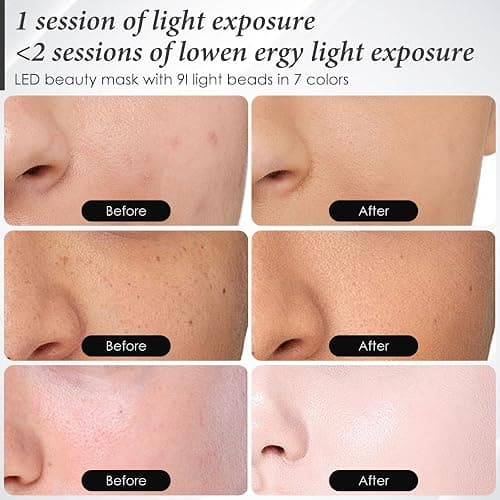 SDKWDH Red Light Mask for Face, 7-1 Colors Facial Care Mask, 850nm Infrared & Red Light Masks, Ergonomic Design for Home & Travel, White thumbnail 7