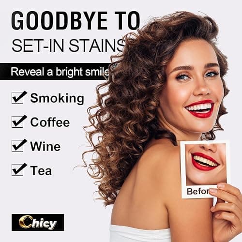 Teeth Whitening Strip for Sensitive Teeth 14 Treatments, Non-Slip Strips, Effective Kit, Fast Result Remove Smoking, Coffee Stains, Professional Tooth Whitening - 28 Non-Slip Strips thumbnail 2