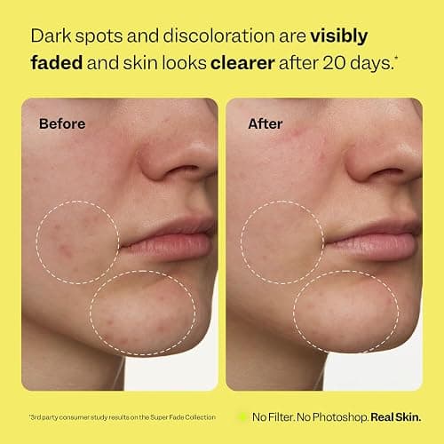 Peach Slices - Super Fade Discoloration Serum for Face (1.01 oz) - Dark Spots, Hyperpigmentation, Uneven Skin - Niacinamide Serum - Tranexamic Acid - Vegan & Cruelty Free - Korean Skin Care & Beauty thumbnail 4