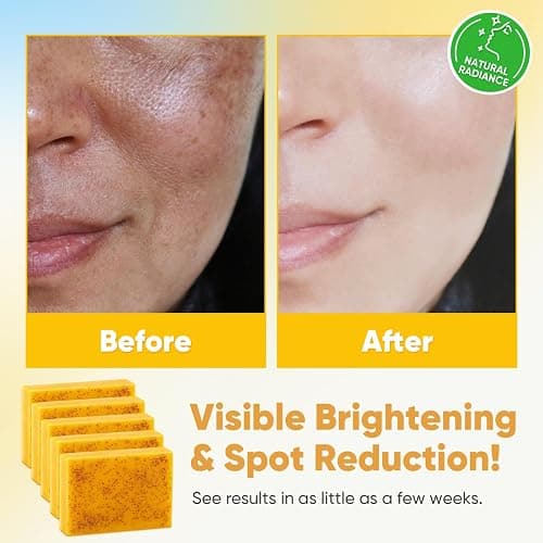 Treeroot 5 Pack Turmeric Soap for Dark Spots, 80g Kojic Acid and Turmeric Soap Bar, Face Even Skin Tone, Natural Potent Moisturizing Ingredient, Contains Vitamin C, Shea Butter, Lemon Oil, Retinol thumbnail 4