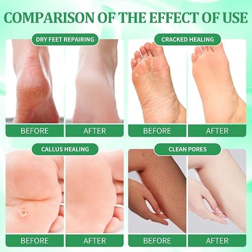 nbc BeautiLab Pedicure Kit Foot Soak Set: Bubble Salt, Sugar Scrub, Massage Mask, Massage Lotion in a Box, 4 Step Foot Spa Kit for Dry Feet,Tired Feet（3 Set Eucalyptus) thumbnail 3