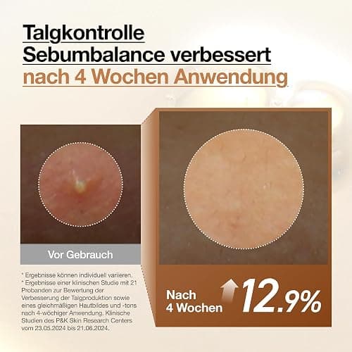 Anua Rice 70 Glow Milky Toner, Korean Skincare, 250ml | Glass & Dewy Skin, Hydration & Barrier Care, Reiswasser, Niacinamid, Ceramide, Alle Hauttypen, Duftstofffrei, Nicht Komedogen thumbnail 6