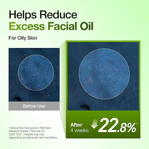Anua Azelaic Acid 10 Hyaluron Redness Soothing Serum, Facial Serum for Blemish-Prone & Oily-Prone Skin, Lightweight & Hydrating Blemish Care, Hyaluronic Acid, Korean Skincare, 1.01 fl oz. thumbnail 7
