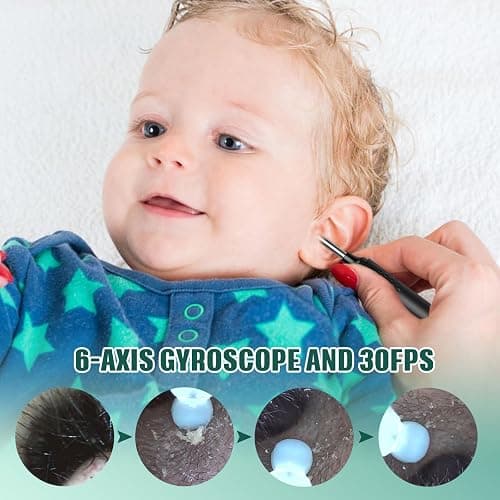 LMECHN Ear Wax Removal, Ear Cleaner with 7 Pcs Ear Set, Ear Wax Removal Tool Camera with 1080P Ear Otoscope & 6 LED Lights, Wireless Ear Pick for Ear Cleaning with 6 Ear Spoons Black thumbnail 3