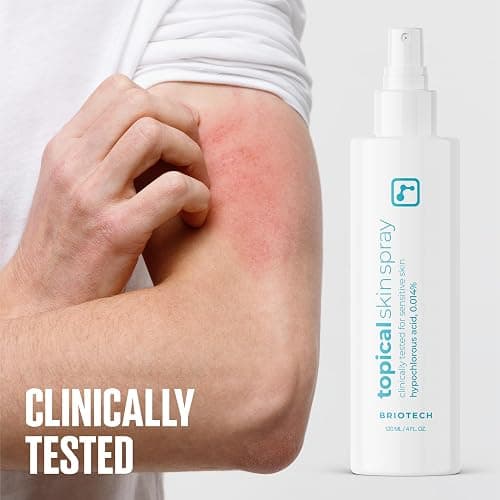 BRIOTECH Topical Skin Spray, Hypochlorous Acid Spray for Sensitive Skin, HOCl Facial Mist, Full Body Support Against Irritation, Calm Redness, Soothe Foot & Scalp, 8 oz (1 Pack) - 8 Ounce (Pack of 1) thumbnail 7