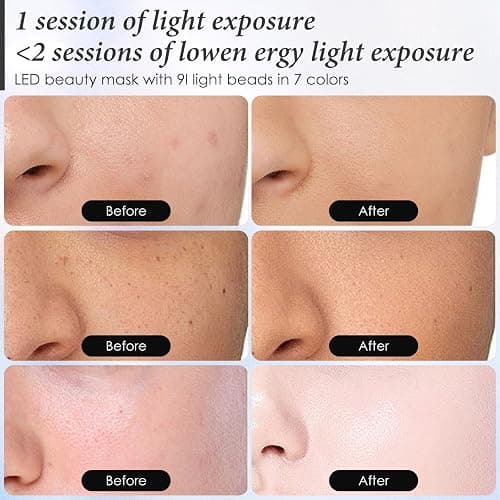 SDKWDH Red Light Mask for Face, 7-1 Colors Facial Care Mask, 850nm Infrared & Red Light Masks, Ergonomic Design for Home & Travel, Pink thumbnail 7