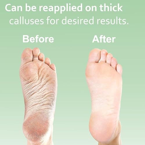 Callus Remover Gel & Foot File thumbnail 5