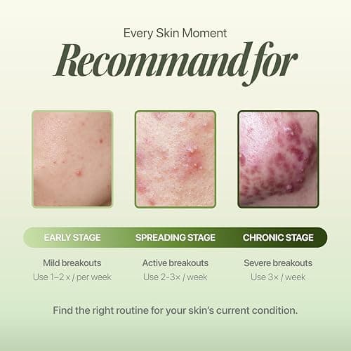 EIOM Trouble Patch Mask – Full Face Hydrocolloid Mask for Acne-Prone Skin | Hydrocolloid Face Mask Whole Face, Face Masks for Acne, Pimple Patch Face Mask, Absorbs Oil & Buildup (20ml x 4) thumbnail 7