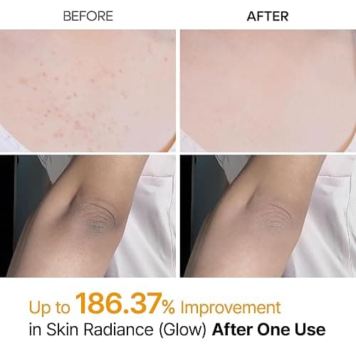 Dr.Melaxin Body Keratin Care Kojic Acid Turmeric Spray Gently Exfoliating Peeling Solution Korean Skincare All Skin Types 200ml thumbnail 3