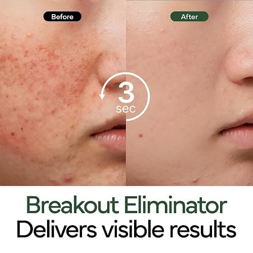 IVOSKIN Intensive Cica Repair Cream, Korean Dexpanthenol cream, Restore Skin Barrier, Prevent Acne Breakouts, Ultra-Soothing & Hydrating Care Cream for Sensitive Skin with Madecassoside (1.76oz / 50g) thumbnail 5
