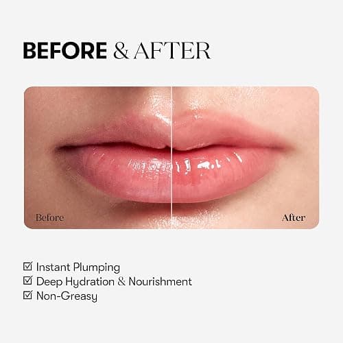VT COSMETICS Reedle Shot Lip Plumper, Hydrating & Volumizing Clear Lip Gloss, Microneedling Effect & Hyaluronic Acid for Fuller, Smoother Lips, Stocking Stuffers, 0.15 oz (4.3 g) (Beginner) thumbnail 4
