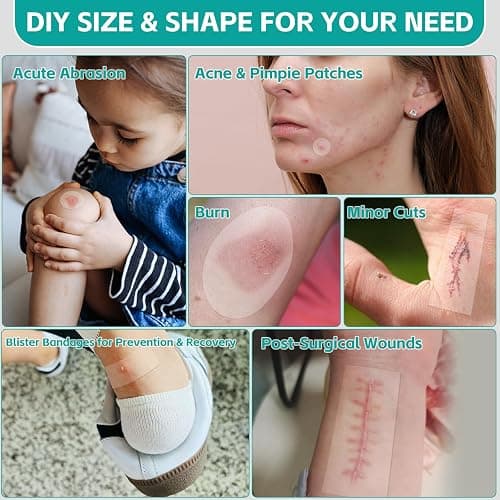New Version Hydrocolloid Roll,2in*16ft Hydrocolloid Bandages for Wound Care,Medical-Grade Hydrocolloid Patch Bandages with Self-Adhesive, Flexible & Waterproof DIY Size & Shape (16FT) thumbnail 4