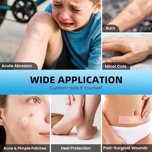 Hydrocolloid Roll Bandages, 2IN x 12FT Extra Large Hydrocolloid Patch with Self-Adhesive, Ultra Absorbent, Cut-to-Size, Flexible & Waterproof for Burn, Blister, Acne Care, First Aid Kit Essential thumbnail 2