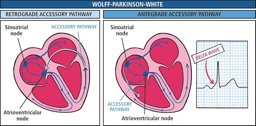 Critical Care and Hospitalist Medicine Made Ridiculously Simple thumbnail 3
