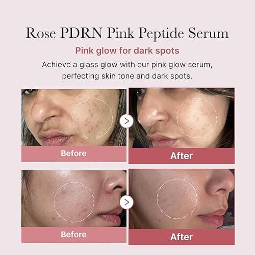 medicube PDRN Pink Peptide Serum, Pink glow serum, Peptide, Niacinamide, Hydrating & Moisturizing & Firming, Uneven Skin Tone, Korean Skincare | 1.01 fl.oz. (1.01 fl.oz., Rose PDRN (Vegan)) thumbnail 2