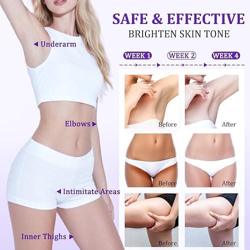 Dark Spot Remover for Body, Skin Bleaching Cream with Vitamin C for Intimate Areas, Skin Lightening Cream Dark Spot Corrector for Underarms, Knees, Face, Elbows, Inner Thighs & Bikini Line,1.7fl oz thumbnail 6